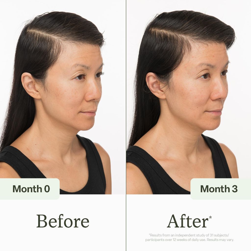 Divi Scalp Serum for Thinning Hair, 30ml – Clinically Tested, Nourishing Formula with Amino Acids, Caffeine & Rosemary Oil