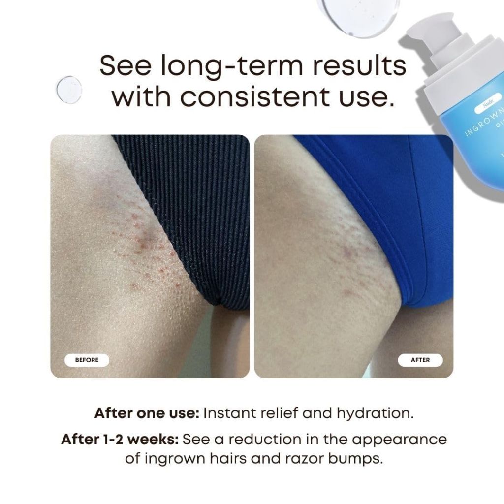 Bushbalm Ingrown Hair Oil - 30 ml (Nude)