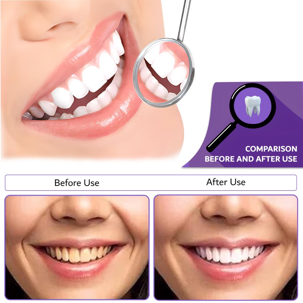 Awanova 30ml Purple Toothpaste for Teeth whitening - 30mL