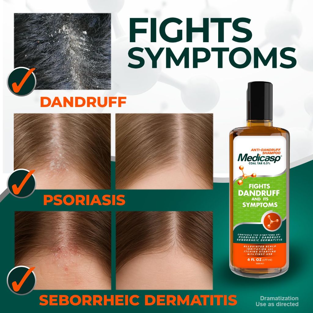 Medicasp Coal Tar Anti-Dandruff Shampoo - 6 fl. oz.