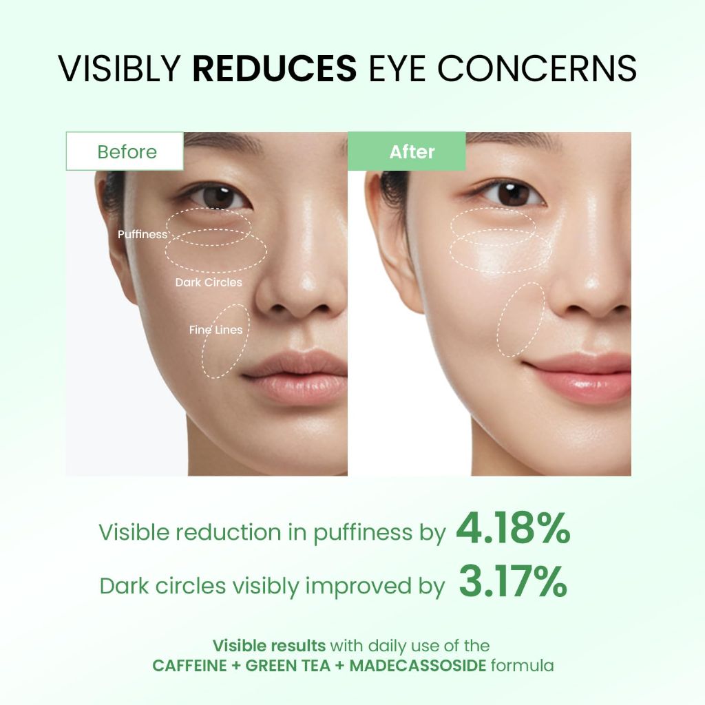 Dongyu Caffeine Eye Cream for Dark Circles, 0.5 fl. oz (Light Green)